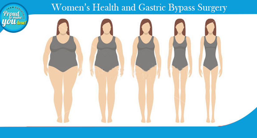 Women’s Health and Gastric Bypass Surgery