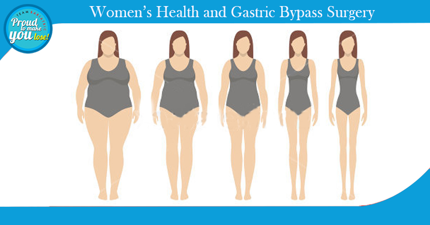 Women’s Health and Gastric Bypass Surgery