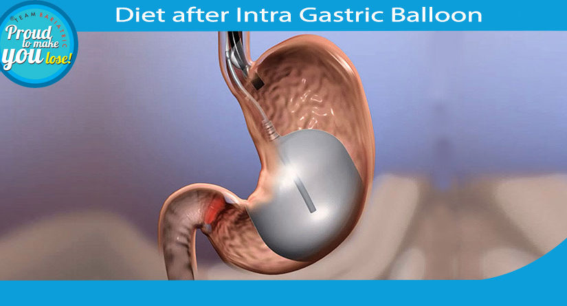 Diet after Intra Gastric Ballooning