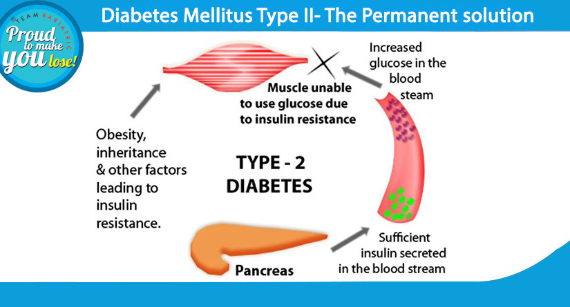 Diabetes Mellitus Type 2 – The Permanent solution