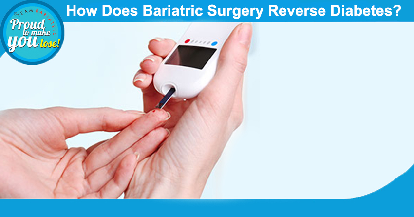 Bariatric Surgery Reverse Diabetes