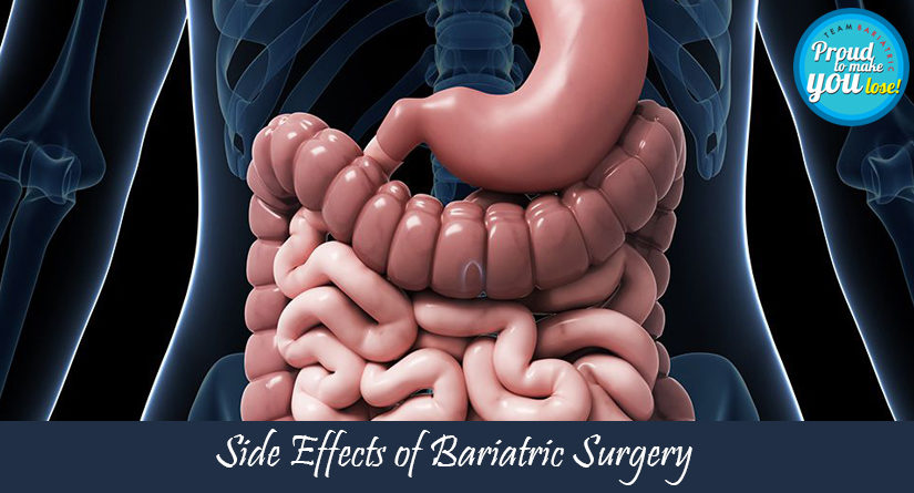 Side Effects of Bariatric Surgery