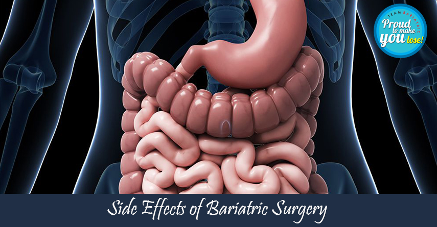 Side Effects of Bariatric Surgery