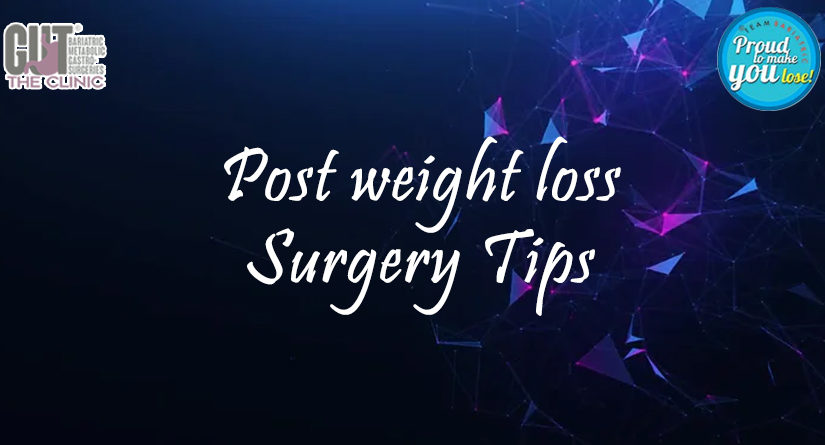 Top Tips For Success After Weight Loss Surgery