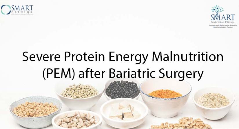 Severe Protein Energy Malnutrition (PEM) after Bariatric Surgery