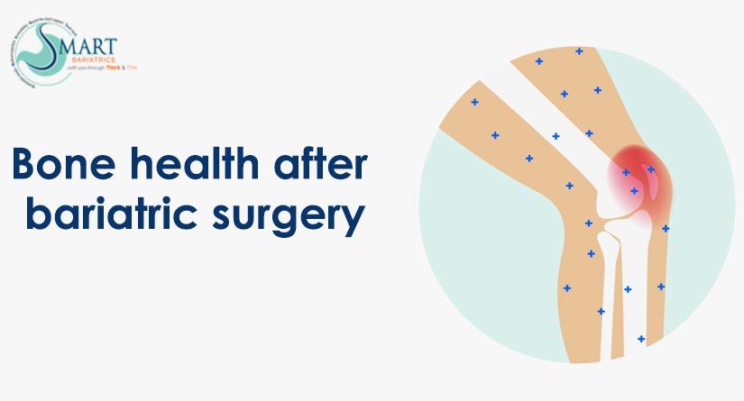 Bone Health after bariatric surgery