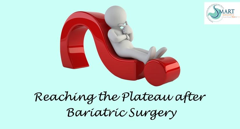 Reaching the plateau after Bariatric Surgery