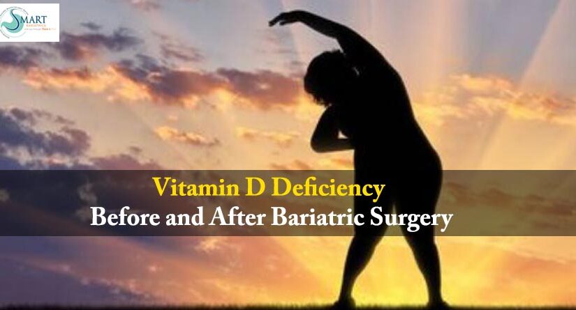 Vitamin D Deficiency Before and After Bariatric Surgery