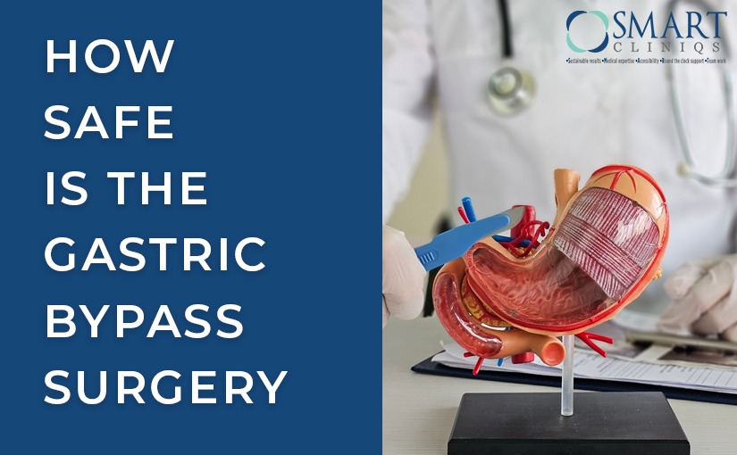 How safe is the Gastric Bypass Surgery