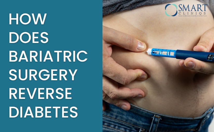 How does Bariatric Surgery reverse Diabetes