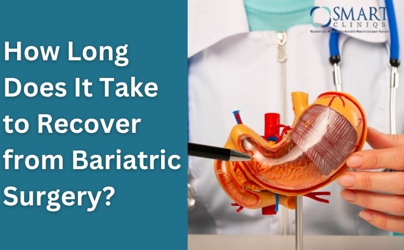 How Long Does It Take to Recover from Bariatric Surgery