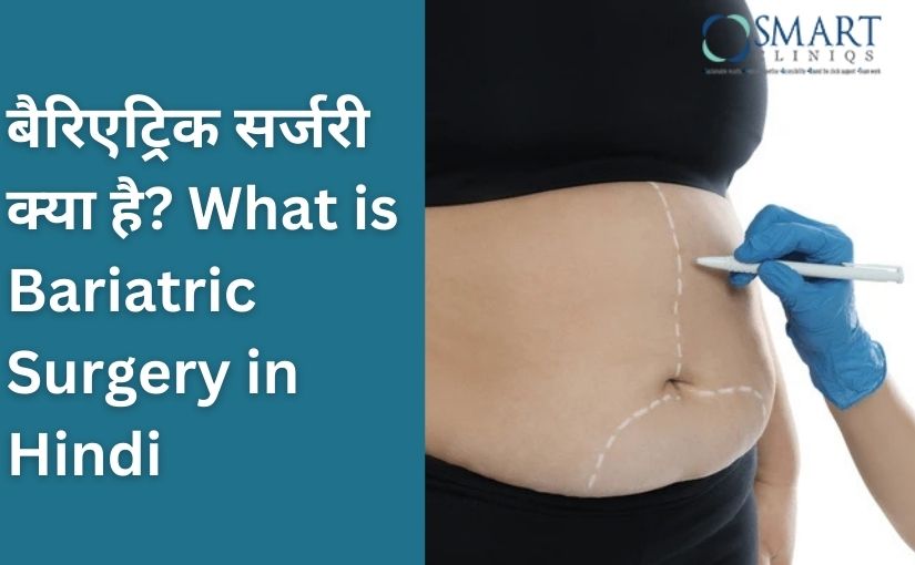 What is Bariatric Surgery in Hindi