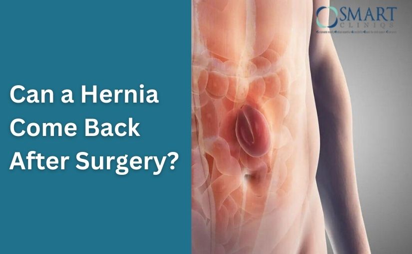 Can a Hernia Come Back After Surgery