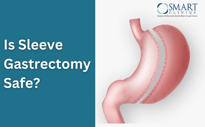 Is Sleeve Gastrectomy Safe