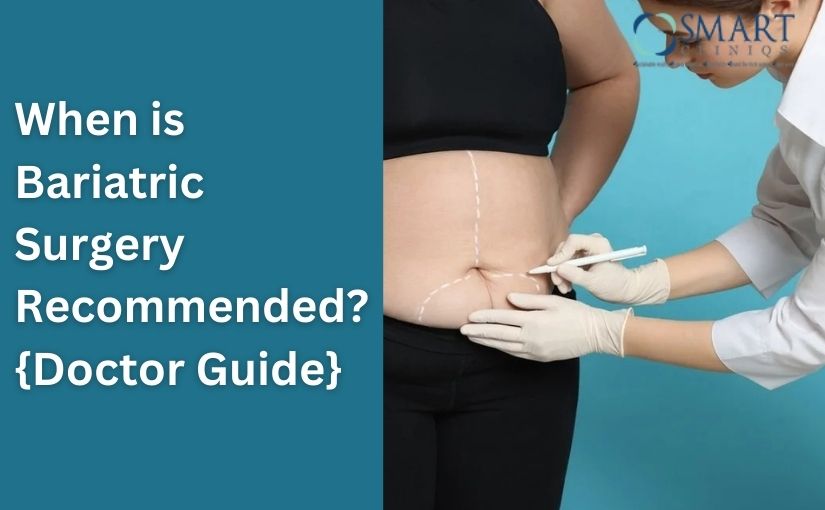 When is Bariatric Surgery Recommended