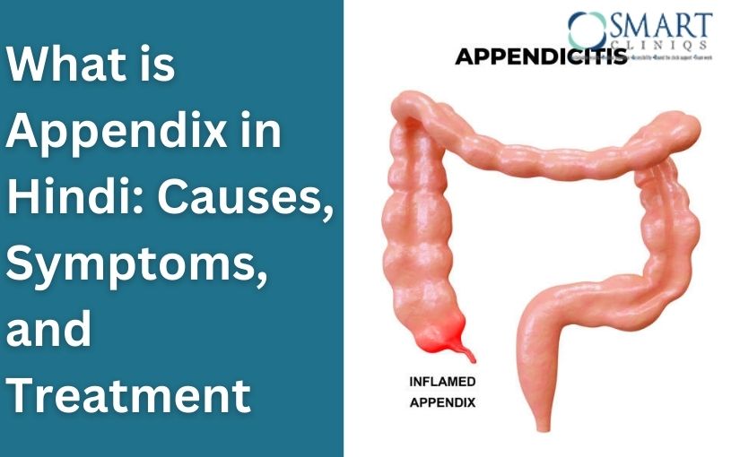 what is appendix in hindi