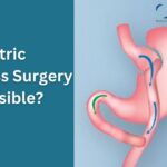 Is Gastric Bypass Surgery Reversible