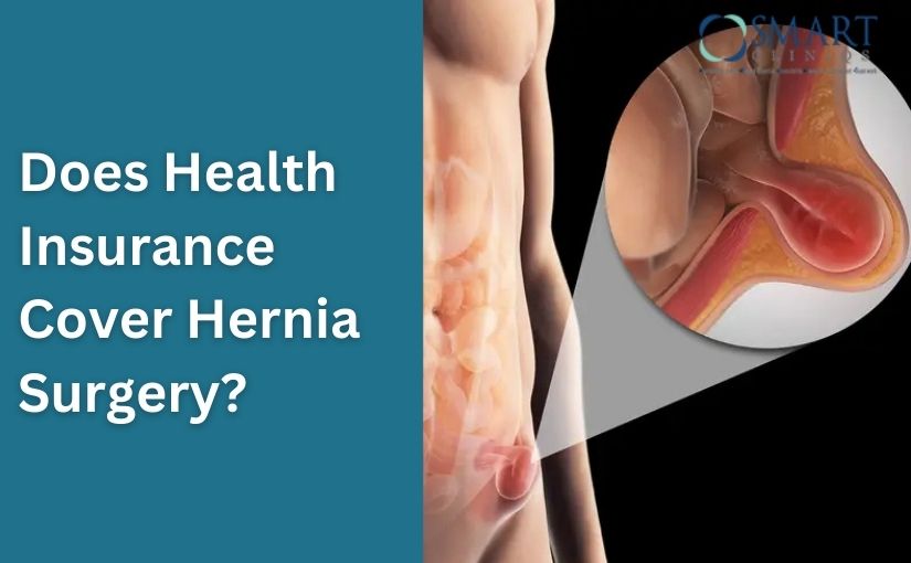 Does Health Insurance Cover Hernia Surgery