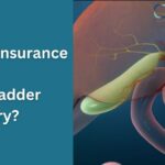 Does Insurance Cover Gallbladder Surgery