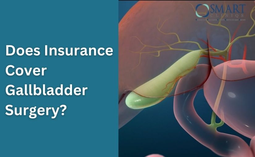 Does Insurance Cover Gallbladder Surgery