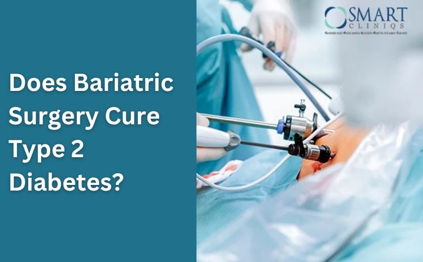 Does Bariatric Surgery Cure Type 2 Diabetes