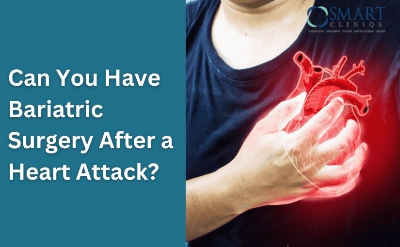 Can You Have Bariatric Surgery After a Heart Attack