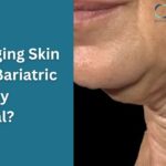 Is Sagging Skin After Bariatric Surgery Normal
