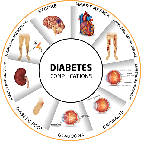 Metabolic Surgery for Diabetes